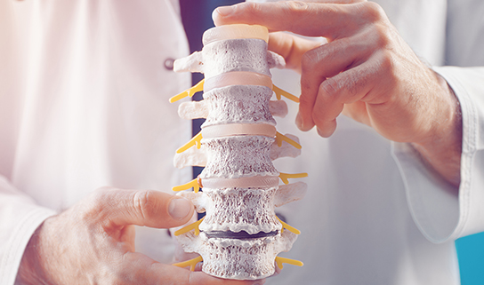 6 Signs You May Need Cervical Disc Replacement