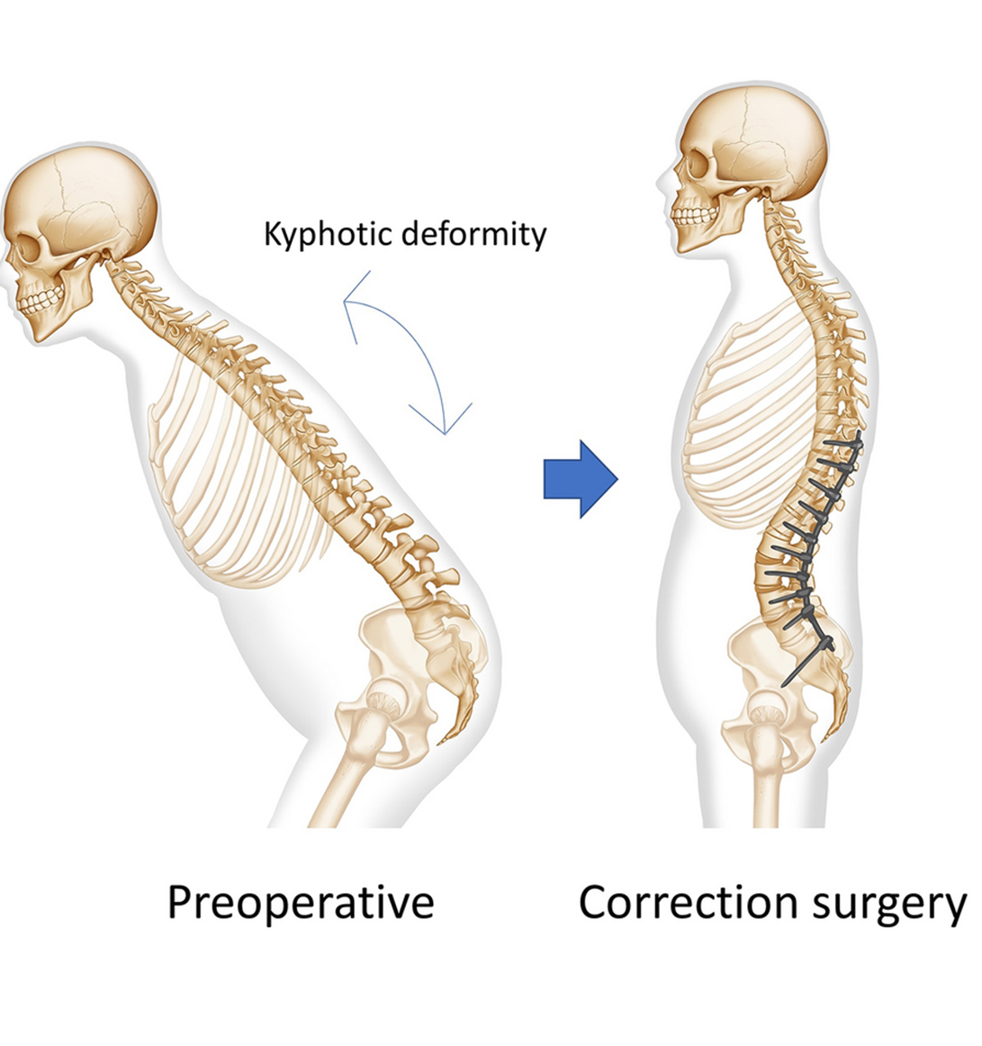 facet-joint-block